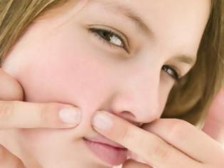 Φωτογραφία για Πως θα αποφύγετε την ακμή;