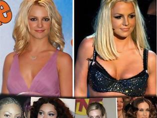 Φωτογραφία για Ποιες διάσημες stars έχουν κάνει πλαστική στήθους; Δείτε photos πριν και μετά τη.. μεγέθυνση!!