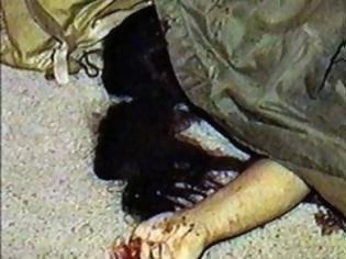 Φωτογραφία για Πακιστανοί σκότωσαν με οξύ την 15χρονη κόρη τους γιατί μίλαγε με αγόρι
