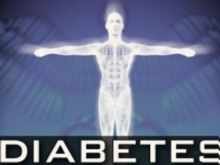 Φωτογραφία για Παγκόσμια ημέρα διαβήτη 14/11: Προσοχή στο διαβητικό πόδι