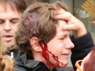 Φωτογραφία για ΣΟΚ: Αστυνομικοί χτύπησαν 13χρονο στο κεφάλι στην Ισπανία- ΒΙΝΤΕΟ