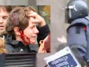 Φωτογραφία για Τα ΜΑΤ στην Ισπανία χτύπησαν με γκλοπ και άνοιξαν το κεφάλι 13χρονου - Δείτε το βίντεο