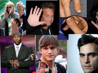 Φωτογραφία για Οι φυσικές ατέλειες των σταρ του Χόλιγουντ: Έξι δάχτυλα, σιαμαίοι, κομμένα άκρα…