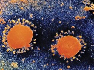 Φωτογραφία για Νέα κρούσματα ιού που μοιάζει με το SARS στη Μέση Ανατολή,