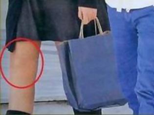 Φωτογραφία για Χάθηκε το γόνατο της Σίσσυς Χρηστίδου στο photoshop!