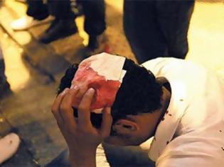 Φωτογραφία για Νέα άγρια ρατσιστική επίθεση - Εξι άνδρες χτυπούσαν νεαρό Αιγύπτιο μέχρι να σωριαστεί
