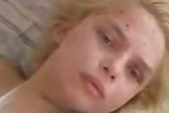 Έσβησε η 18χρονη Oksana που βιάστηκε και πυρπολήθηκε!