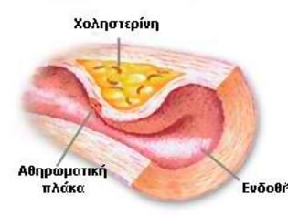 Φωτογραφία για Θα ανακουφιστούν ασθενείς με αθηροσκλήρυνση από έρευνα στα Γιάννινα!