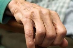 Κέκρυρα: Ξεψύχησε θύμα τροχαίου