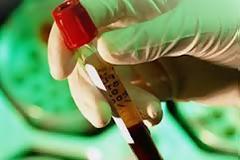 Αποζημίωση 800.000 ευρώ για μόλυνση με AIDS από μετάγγιση