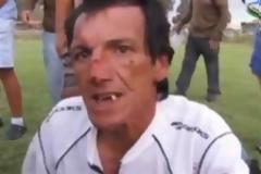 Ξύλο δίχως έλεος σε διαιτητή στη Χιλή [video]