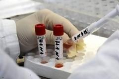 Τέλος Ιανουαρίου έρχεται η γρίπη στην Ελλάδα