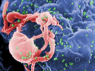 Φωτογραφία για Έφτιαξαν με μοριακά ψαλίδια, κύτταρα ανθεκτικά στον HIV