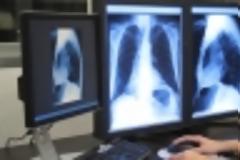 Με λουκέτο απειλούνται 4500 διαγνωστικά εργαστήρια από το κούρεμα! Τι φοβούνται οι γιατροί