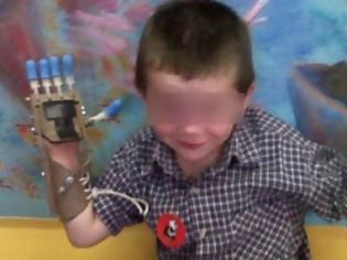 Φωτογραφία για Κάνει θαύματα η τεχνολογία - Μηχανικοί έφτιαξαν ένα ρομποτικό χέρι για πεντάχρονο αγόρι [video]
