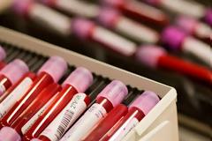 Η ομάδα αίματος δείχνει ποιoς κινδυνεύει από καρδιοπάθειες