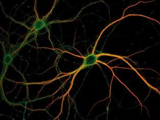 Φωτογραφία για Τα κύτταρα του εγκεφάλου «μπορούν να ζήσουν περισσότερο από το σώμα»