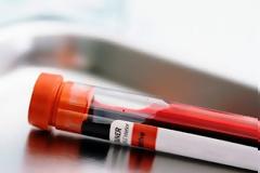 Απολύθηκε Νορβηγίδα εκπαιδευτικός με «γευσιγνωστικές« ανησυχίες για το αίμα