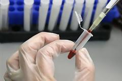 ΥΓΕΙΑ: Τεστ αίματος θα επιτρέπει την εξατομικευμένη αντικαρκινική θεραπεία
