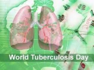 Φωτογραφία για Ανακοίνωση από τη διεύθυνση δημόσιας υγείας της ΠΚΜ για την παγκόσμια ημέρα κατά της φυματίωσης