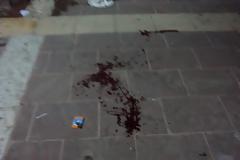 Βάφτηκε με αίμα η Κεντρική Πλατεία της Ξάνθης!