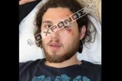 Ξυλοκόπησαν φoιτητή επειδή αρνήθηκε να πληρώσει χωρίς απόδειξη!