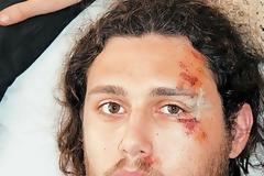 Φοιτητής στην Κομοτηνή έκανε το λάθος να ζητήσει... απόδειξη!