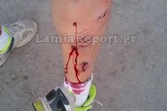 Λαμία: Άγρια επίθεση σκύλου σε ποδηλάτη - ΦΩΤΟ