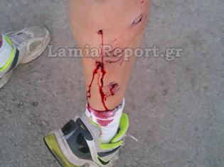 Φωτογραφία για Λαμία: Άγρια επίθεση σκύλου σε ποδηλάτη - ΦΩΤΟ