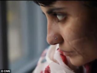 Φωτογραφία για Tης άνοιξε το κεφάλι με τσεκούρι για την... τιμή του!