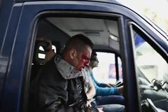 Με τραύματα στο κεφάλι και μώλωπες νοσηλεύεται ο ειδικός φρουρός