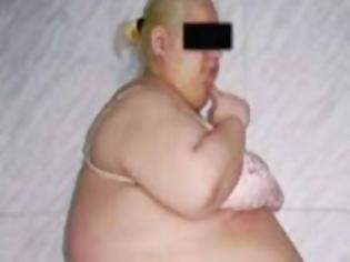 Φωτογραφία για Έκοψαν την κοιλιά της που ζύγιζε 57 κιλά
