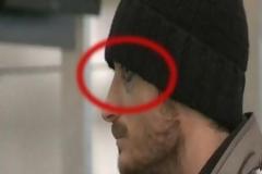 Με μαυρισμένο μάτι ο Ριέρα από τις μπουνιές του Μέλο