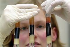 ΥΓΕΙΑ: Μία ακόμα μικρή μάχη στον πόλεμο κατά του AIDS κερδίζουν οι επιστήμονες