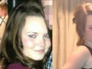Φωτογραφία για 17χρονη πέθανε από λευχαιμία ενώ της έλεγαν ότι έχει αμυγδαλίτιδα