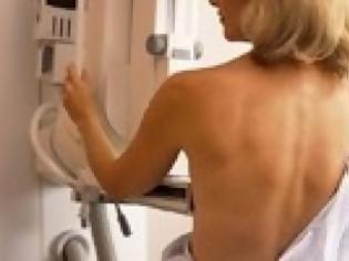 Φωτογραφία για Υγεία: Οι ανδρικές ορμόνες ευθύνονται για την εμφάνιση του καρκίνου του μαστού