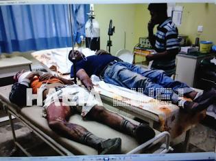 Φωτογραφία για Βουρπασία: «Γάζωσαν» στο ψαχνό τους αλλοδαπούς εργάτες – Στο νοσοκομείο 28 άτομα – Δείτε φωτο