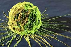 Ογκολόγοι καταγγέλλουν ακρίβεια στα αντικαρκινικά φάρμακα