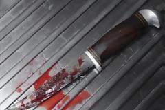 ΗΠΑ: 50χρονη ευνούχισε τον πρώην σύζυγό της