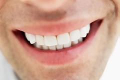 Ποιος είναι ο ... «ασπροδόντης» γαλάζιoς βουλευτής;