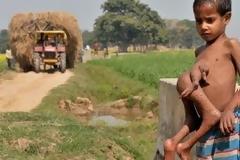 ΣΟΚΑΡΙΣΤΙΚΟ VIDEO: Δείτε τον επτάχρονο που έχει τέσσερα πόδια και τέσσερα χέρια