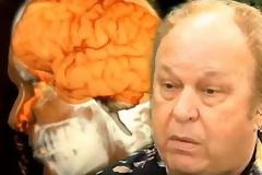 «Έτρεχε» ο εγκέφαλος από τη… μύτη του