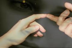 15χρονη Μυρτώ: Δείτε τα τελευταία νέα για την κατάσταση της υγείας της…