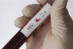 Υγεία: ΣΟΚ - Σταμάτησαν τις εξετάσεις για το AIDS