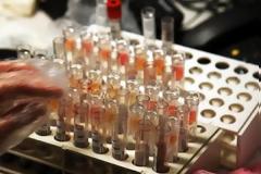 Τέλος στις εξετάσεις για τον ιό του AIDS