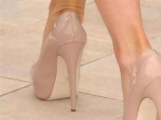 Φωτογραφία για Σοκαριστική φωτο: Δείτε μια ακτινογραφία σε γυναικείo πόδι με γόβα...
