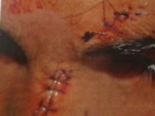 Φωτογραφία για Έρευνα από την ΕΛΑΣ για την κακοποίηση του 15χρονου Αφγανού