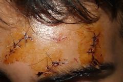 Ακτινοβολώντας