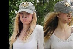 Ξόδεψε 1,7 εκατομμύρια ευρώ για 100 πλαστικές και τώρα άρχισε να αφαιρεί τα ενθέματα