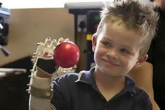 Το 3D printing βοηθάει στην δημιουργία τεχνιτών μελών για άτομα με αναπηρία! [Video]